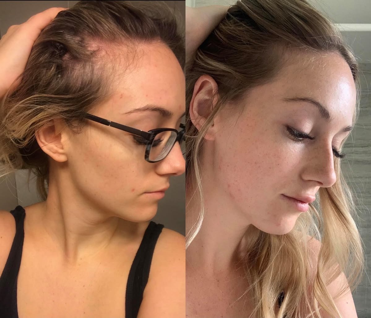 Before and after